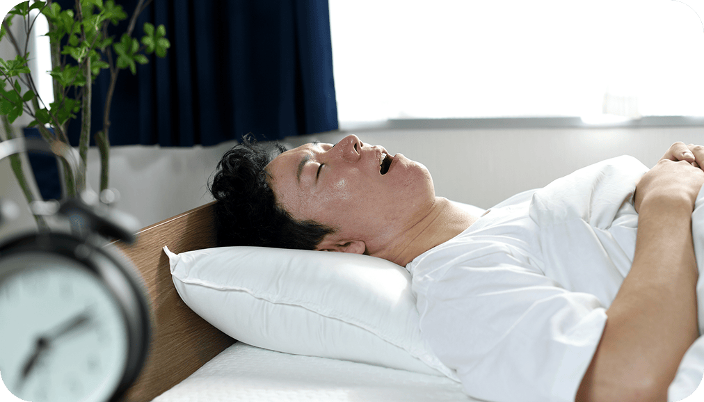 眠時無呼吸症候群（SAS）のイメージ